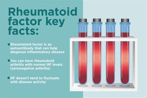 A rheumatoid factor test is one of a group of blood tests primarily used to help pinpoint a diagnosis of rheumatoid arthritis. . Rheumatoid factor over 100